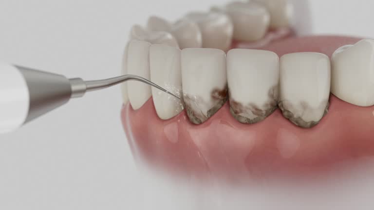 Trusted Teeth Whitening service in McComb, OH - Dentist Open Now